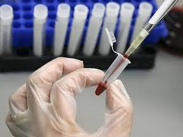 Bệnh nhân tiểu đường cần xét nghiệm hemoglobin A1c
