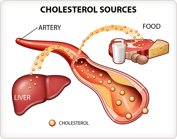 Cholessterol cao dẫn đến nguy cơ cao huyết áp