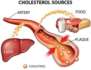cholesterol1