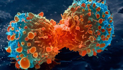 Những phát hiện mới trong điều trị ung thư mang lại hy vọng cho người bệnh