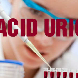 Acid uric là gì? Khi Acid uric trong máu bao nhiêu thì bị bệnh gout?