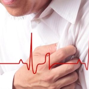 Những điều cần biết về bệnh nhồi máu cơ tim