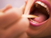 Close-up of a doctor examining a young woman's throat with a tongue depressor
