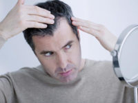 Giải pháp ngừa rụng tóc ở tuổi trung niên