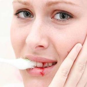 Chảy máu răng là dấu hiệu của bệnh ung thư nguy hiểm gì?