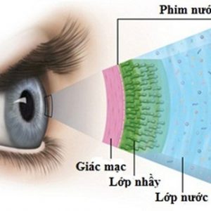 Giải pháp nào tốt nhất dành cho đôi mắt mỏi và khô?
