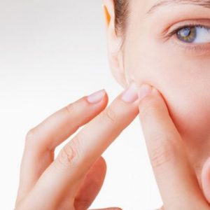 Hướng dẫn cách chăm sóc da sau nặn mụn an toàn