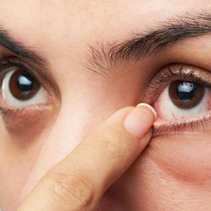 Những nguyên nhân gây ra các bệnh về mắt thường gặp