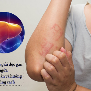 Uống thuốc giải độc gan bị ngứa – Nguyên nhân và hướng xử lý đúng cách