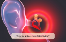 Viêm tai giữa có nguy hiểm không