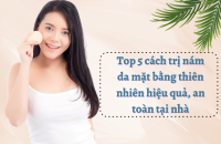 Top 5 cách trị nám da mặt bằng thiên nhiên hiệu quả, an toàn tại nhà