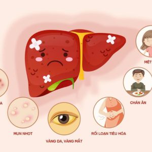 Nóng Trong, Nổi Mụn, Mẩn Ngứa Có Phải Do Gan Đang “Kêu Cứu”?