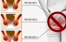 Bệnh trĩ nội độ 1 có tự khỏi được không?