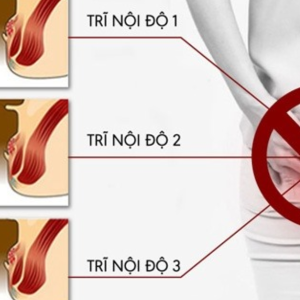 Bệnh trĩ nội độ 1 có tự khỏi được không?